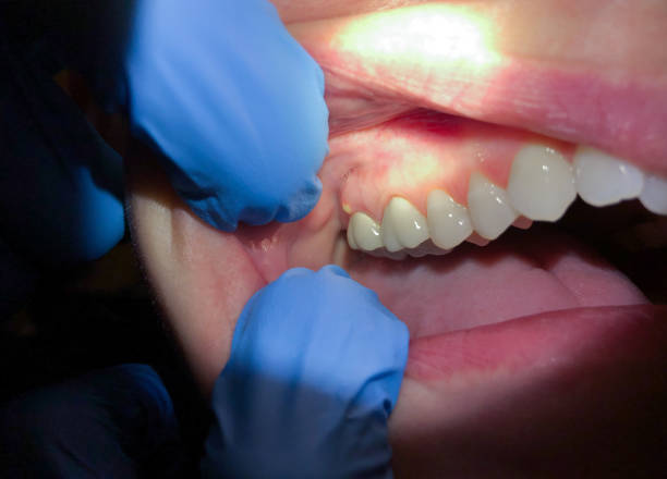 Best Emergency Care for Gum Disease in Farmersville, OH